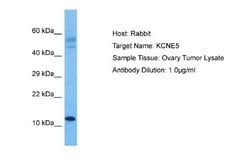 KCNE1-like Rabbit anti-Human, Polyclonal, Novus Biologicals 0.1 mL | Buy Online | Novus Biologicals | Fisher Scientific
